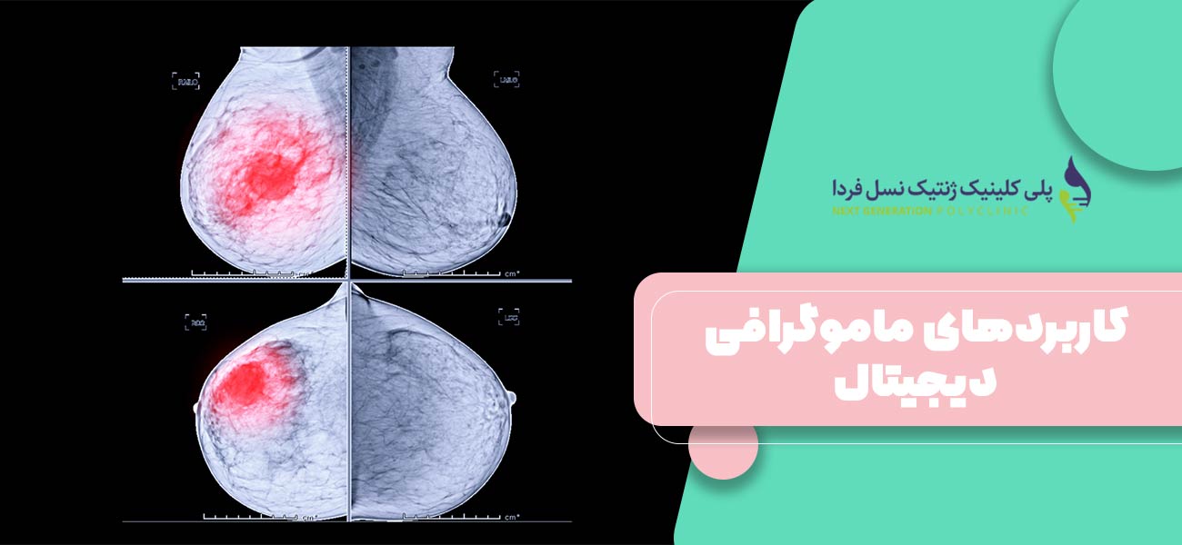 کاربردهای ماموگرافی دیجیتال