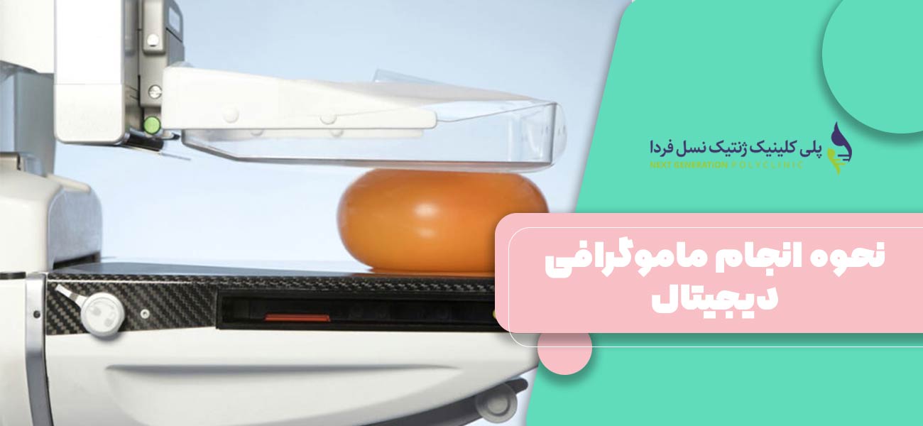 نحوه انجام ماموگرافی دیجیتال
