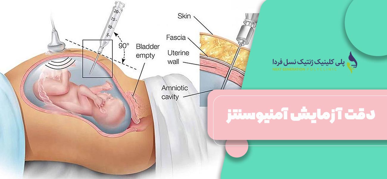 دقت آزمایش آمنیوسنتز