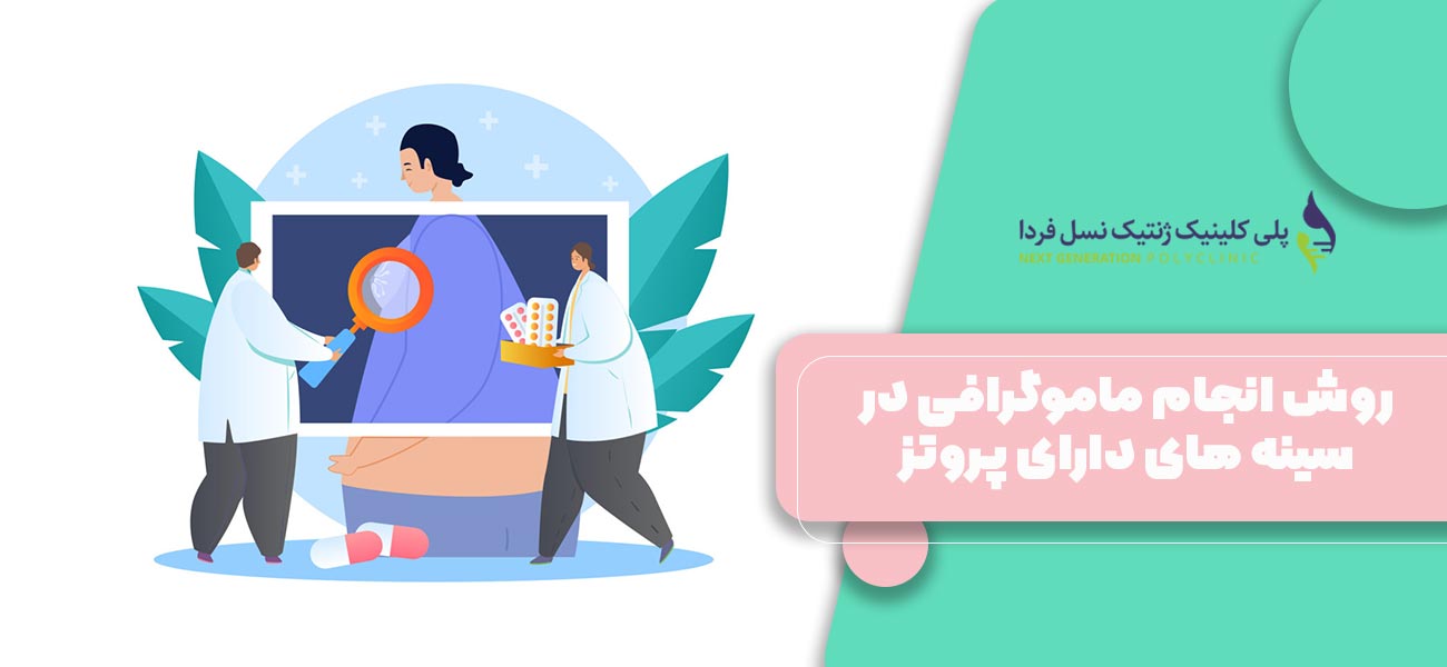 آیا ماموگرافی باعث جابجایی پروتز سینه می شود ؟