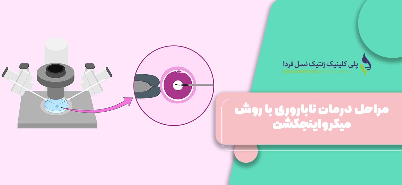مراحل درمان ناباروری با روش میکرواینجکشن