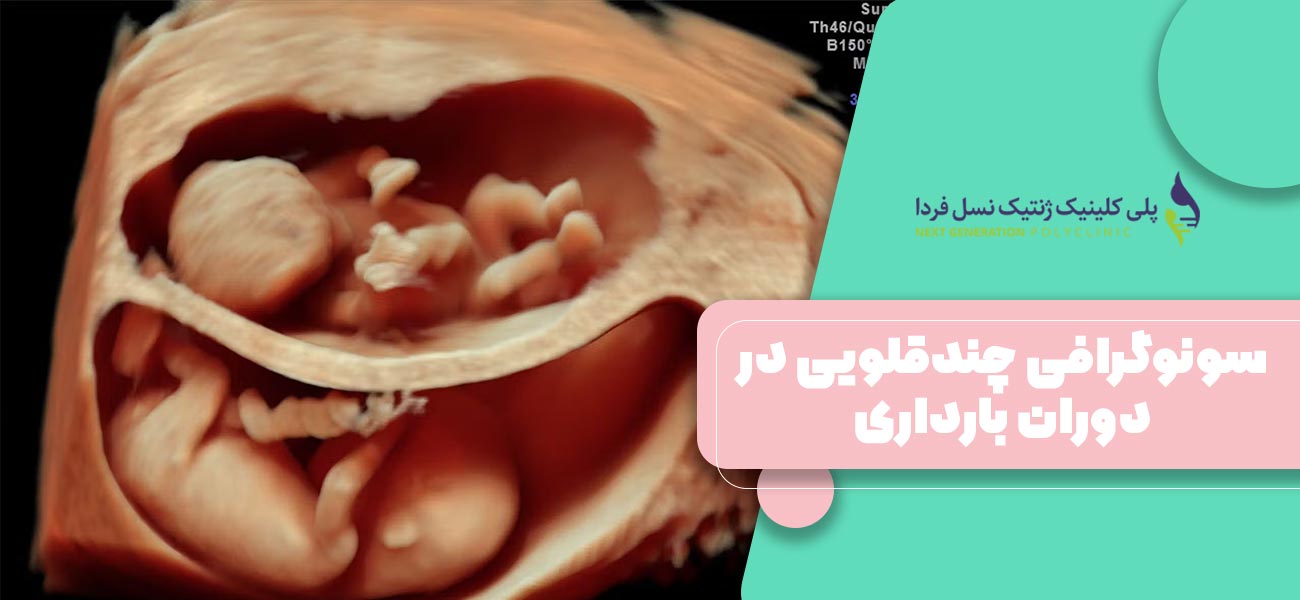 سونوگرافی چندقلویی در دوران بارداری