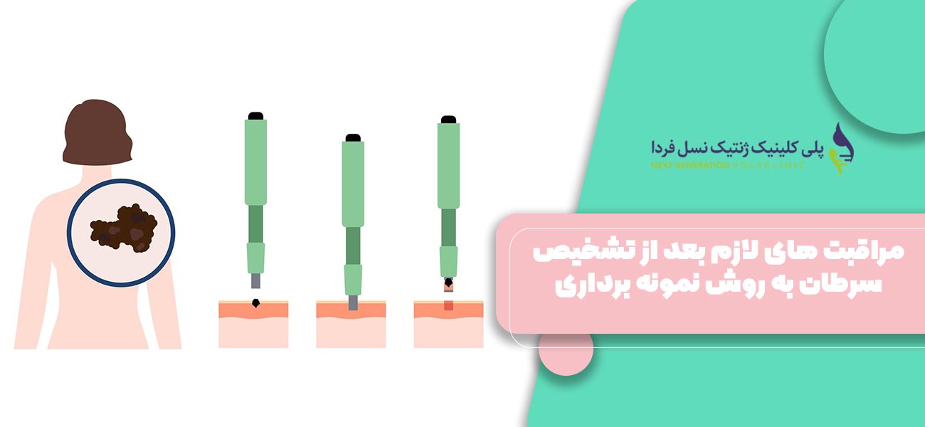 مراقبت های لازم بعد از تشخیص سرطان به روش نمونه برداری