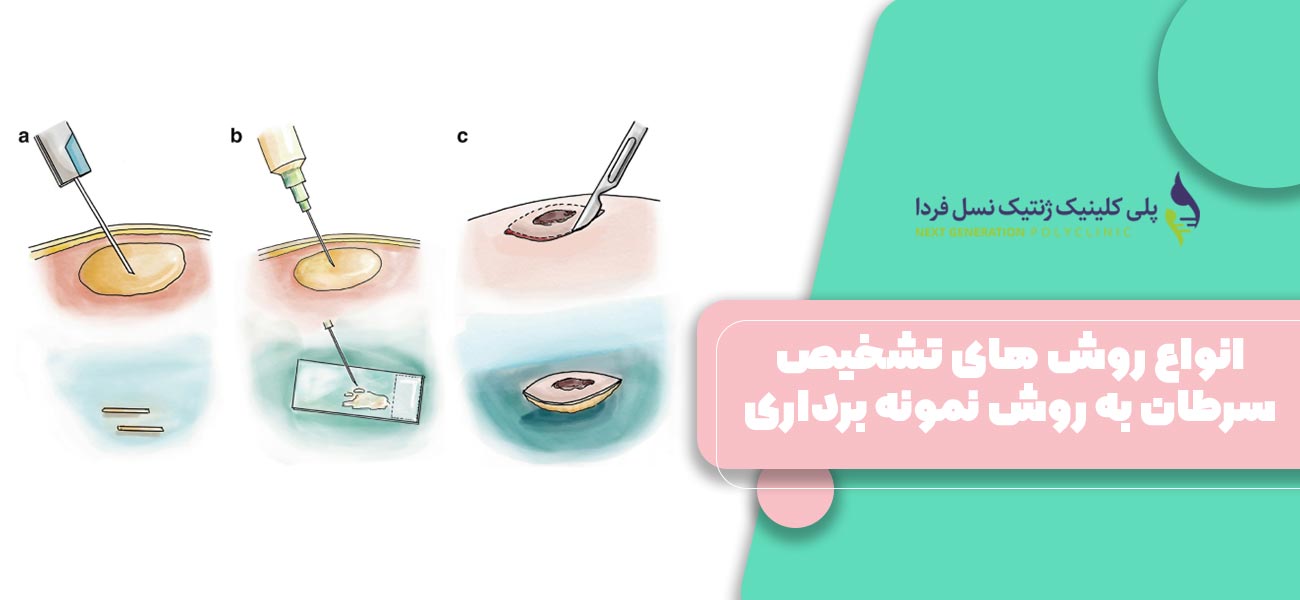 انواع روش های تشخیص سرطان به روش نمونه برداری