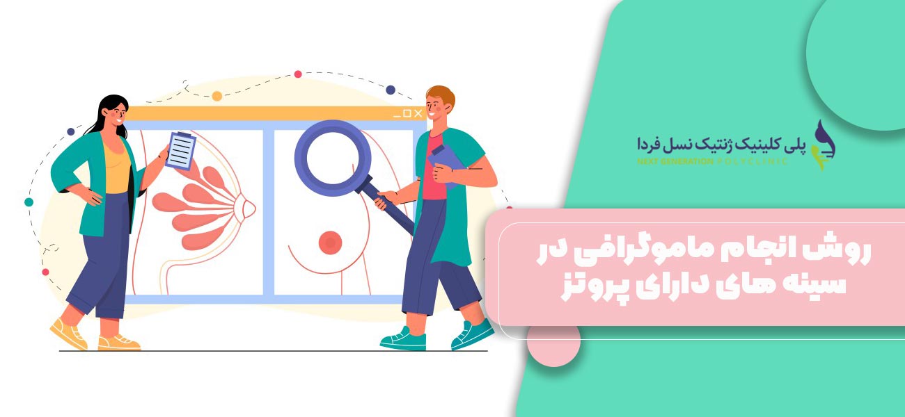 بعد از ماموگرافی در سینه های دارای پروتز چه کنیم؟