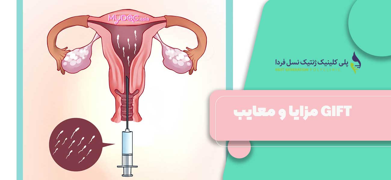 مزایا و معایب GIFT