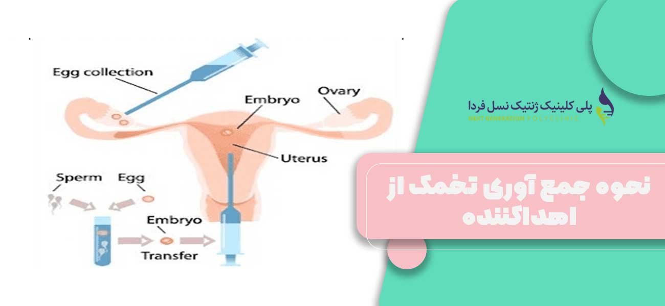 نحوه جمع آوری تخمک از اهداکننده