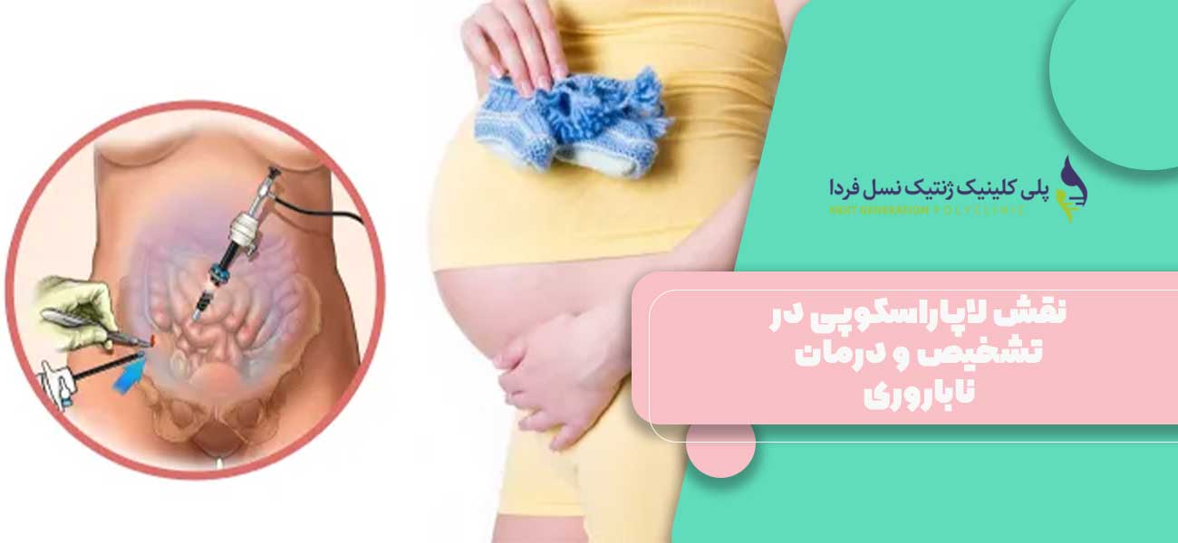 نقش لاپاراسکوپی در تشخیص و درمان ناباروری