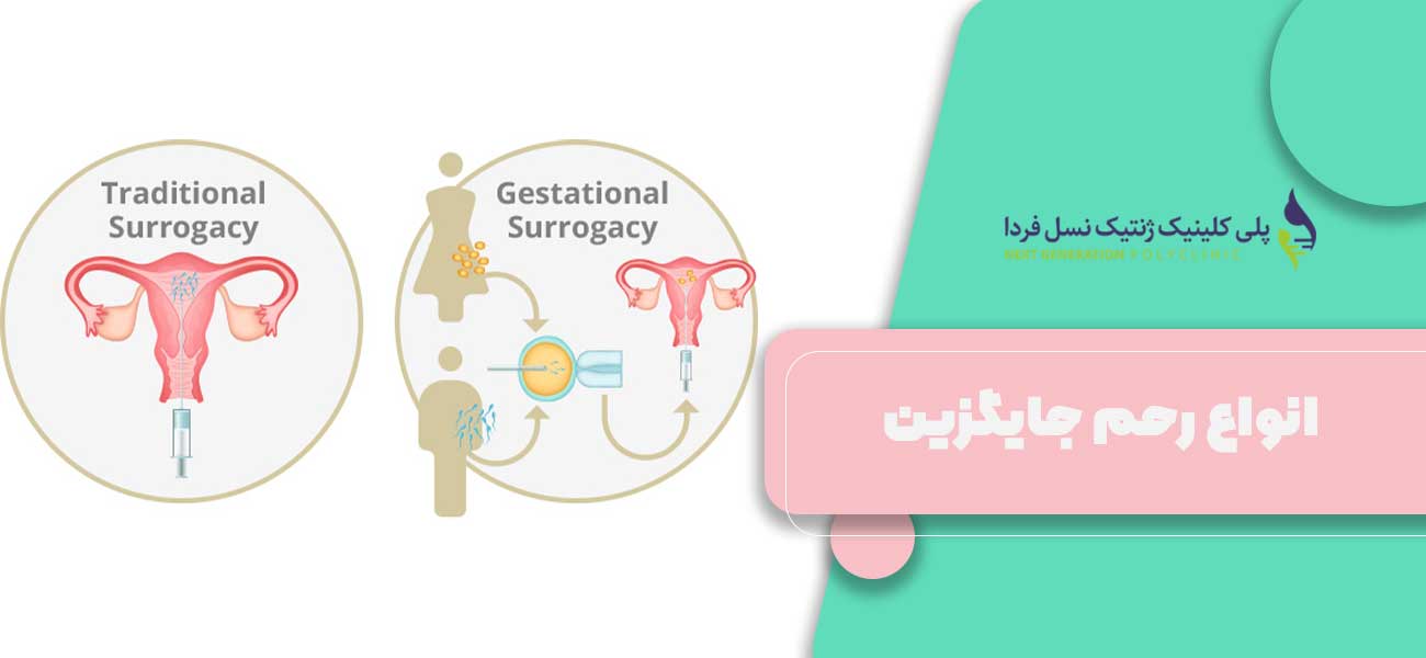 انواع رحم جایگزین