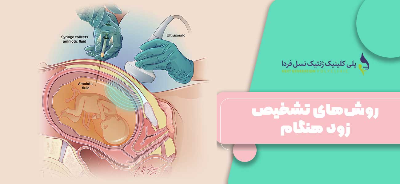 روشهای تشخیص زود هنگام