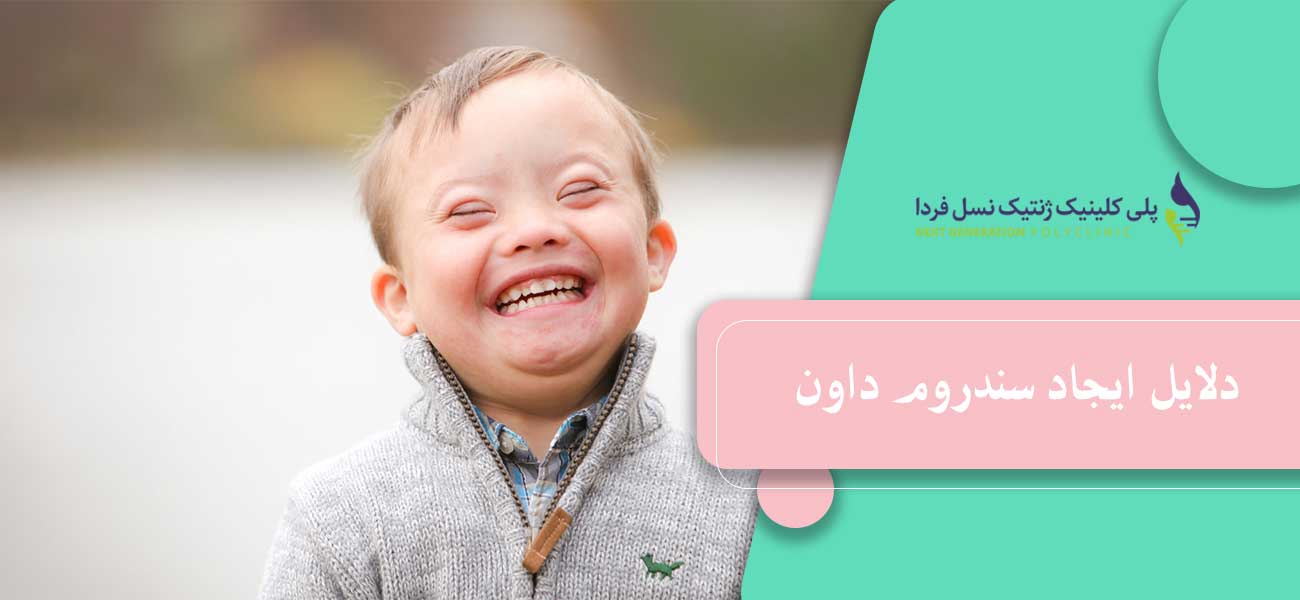 دلایل ایجاد سندروم داون