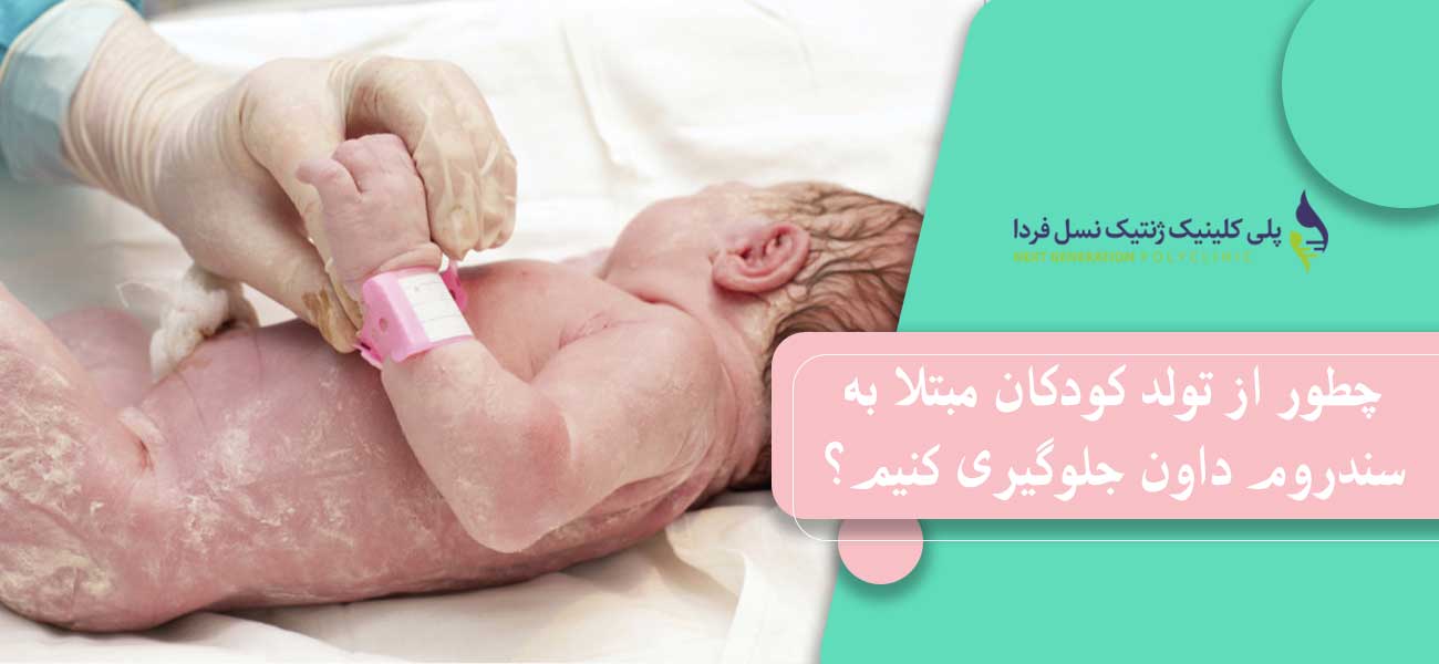 چطور از تولد کودکان مبتلا به سندروم داون جلوگیری کنیم؟
