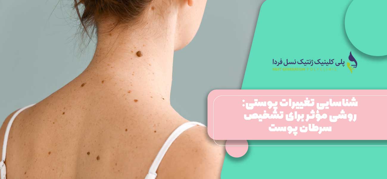 شناسایی تغییرات پوستی: روشی مؤثر برای تشخیص سرطان پوست