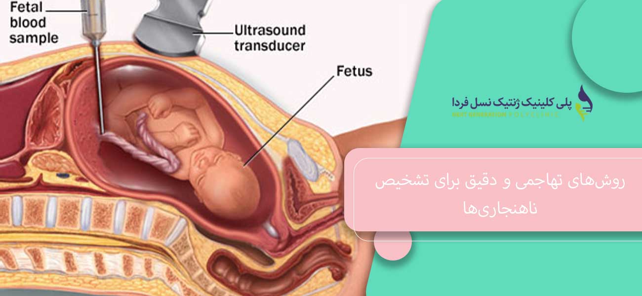 روشهای تهاجمی و دقیق برای تشخیص ناهنجاریها