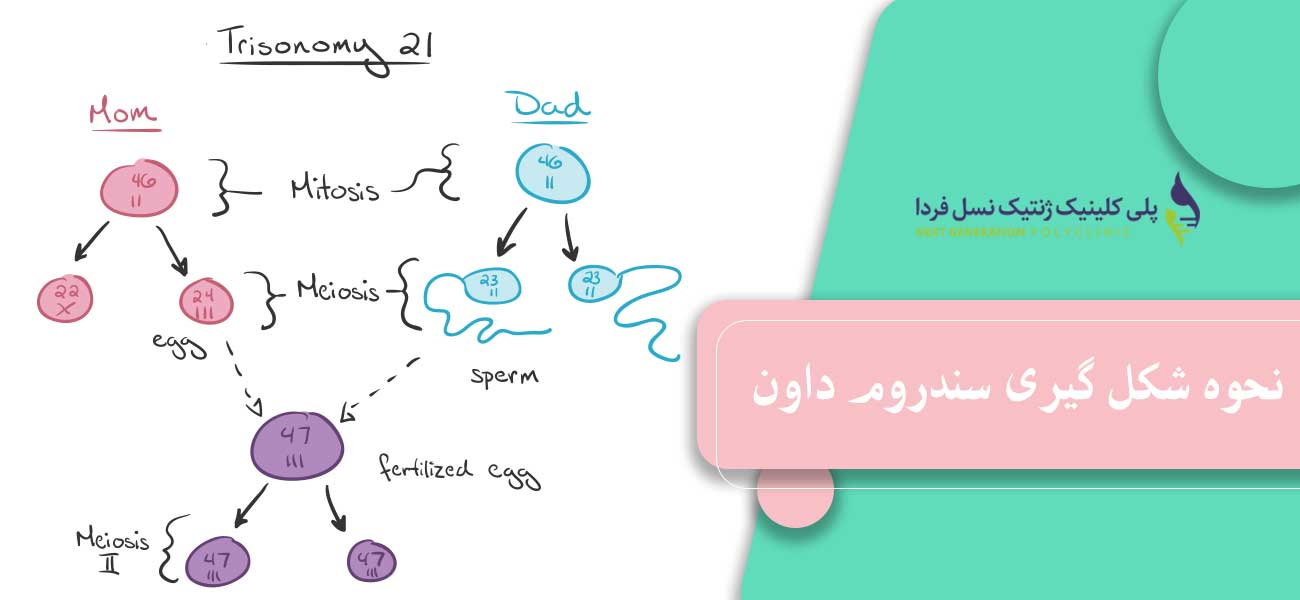 نحوه شکل گیری سندروم داون