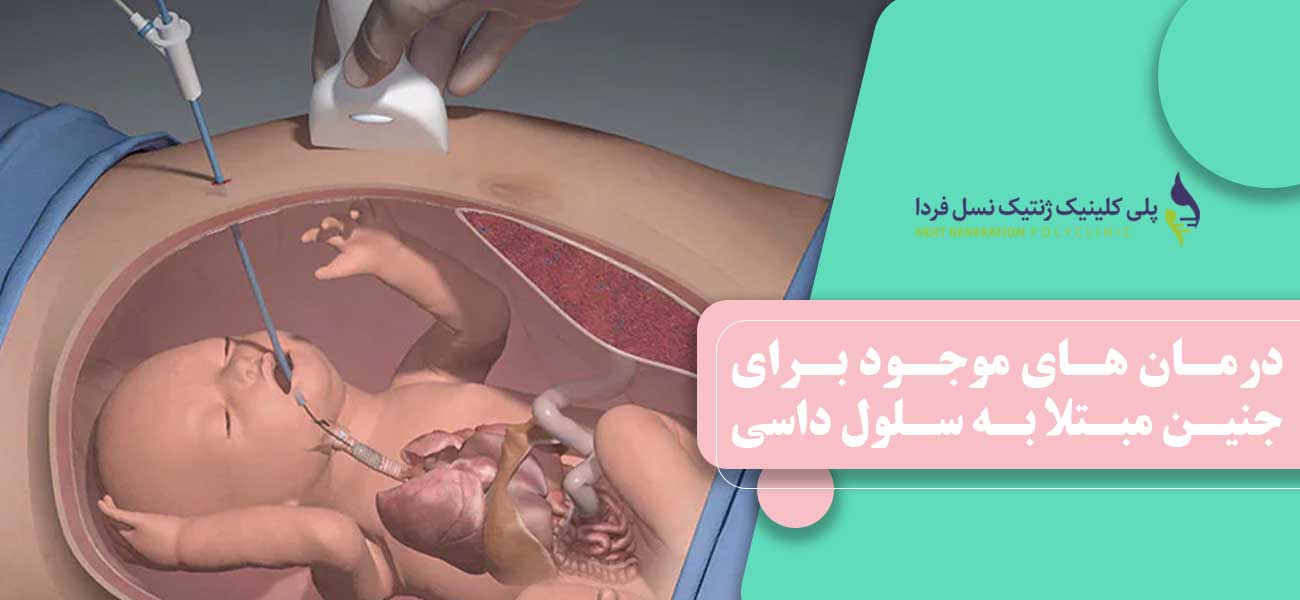 درمان های موجود برای جنین مبتلا به سلول داسی شکل