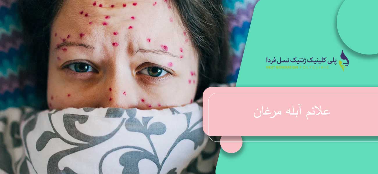 علائم آبله مرغان