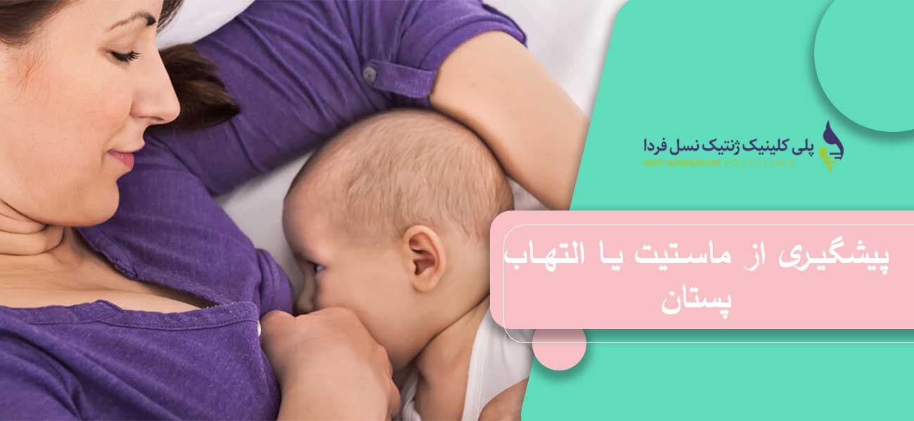 پیشگیری از ماستیت یا التهاب پستان