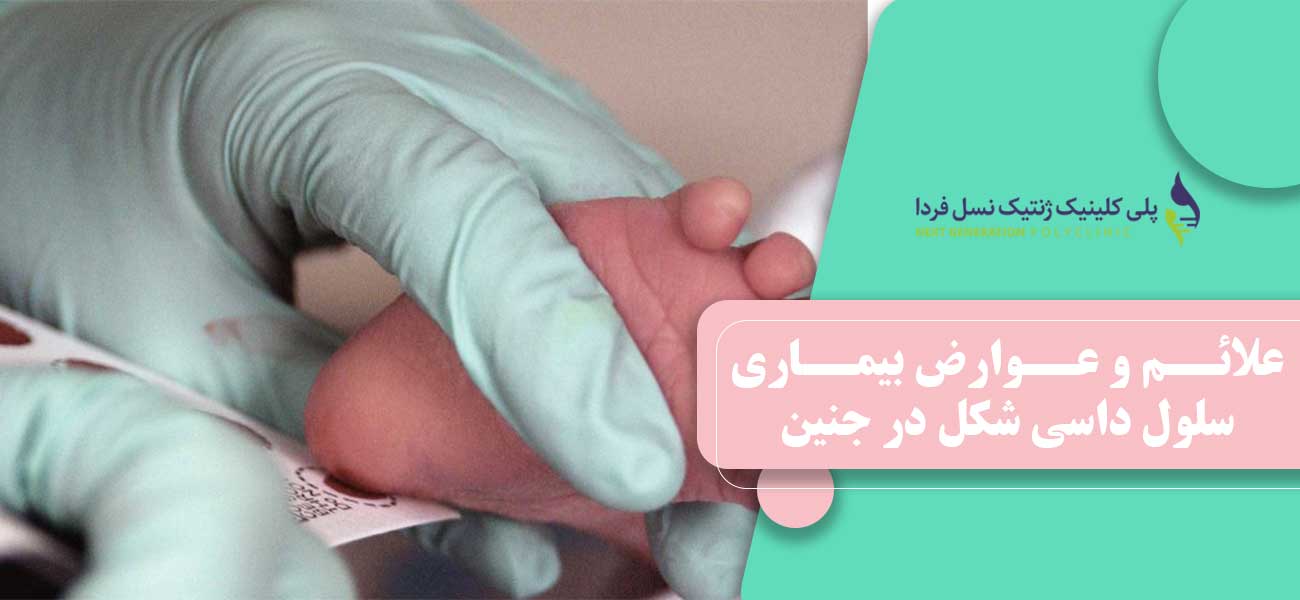 علائم و عوارض بیماری سلول داسی شکل در جنین