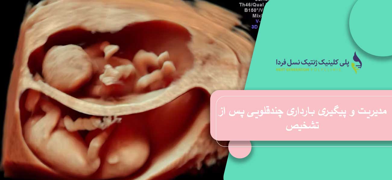 مدیریت و پیگیری بارداری چندقلو پس از تشخیص