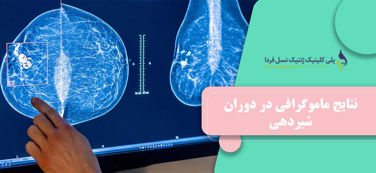 نتایج ماموگرافی در دوران شیردهی