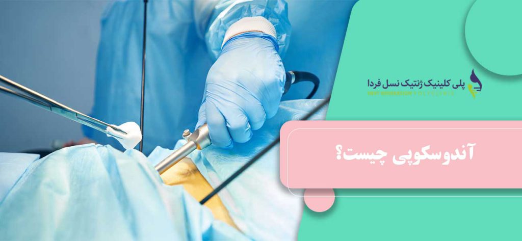 آندوسکوپی چیست؟