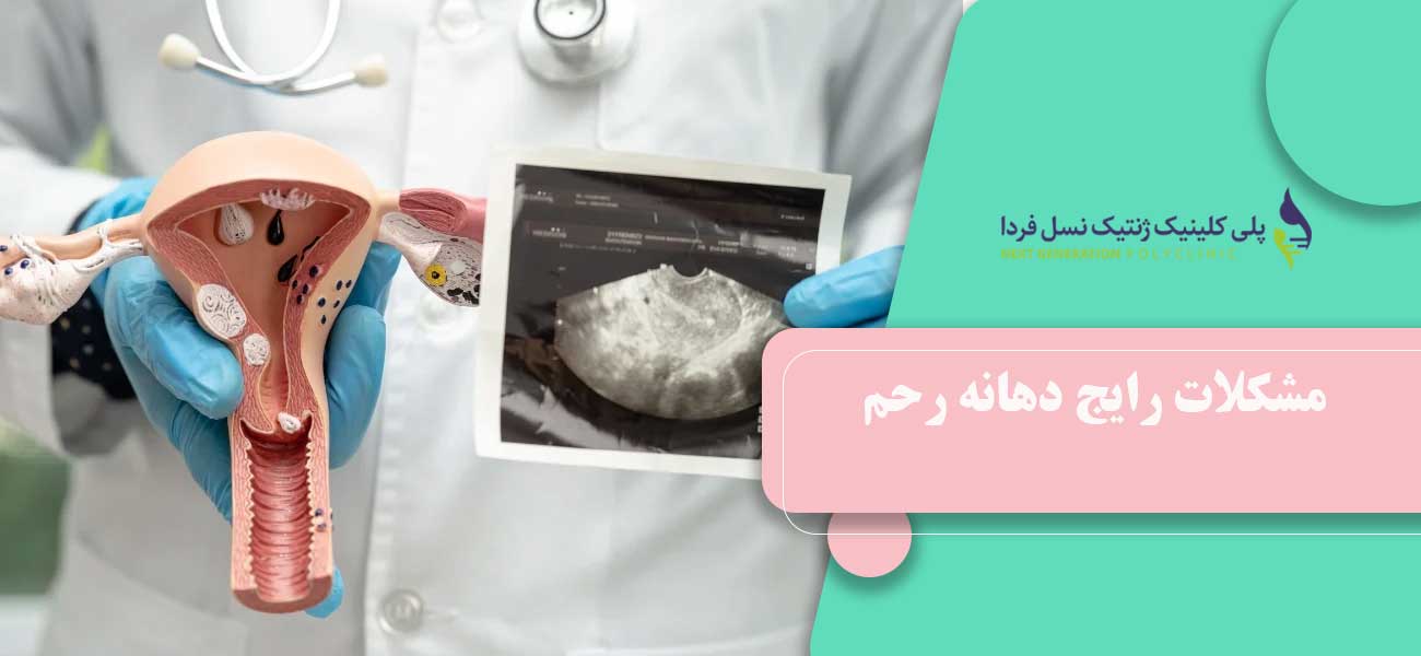 مشکلات رایج دهانه رحم