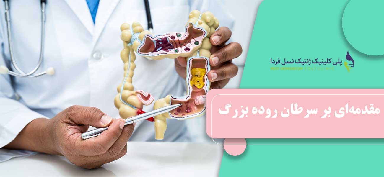 مقدمهای بر سرطان روده بزرگ