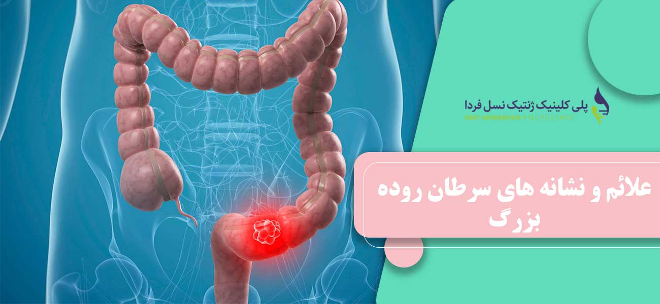 علائم و نشانه های سرطان روده بزرگ