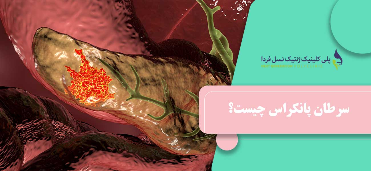 سرطان پانکراس چیست؟