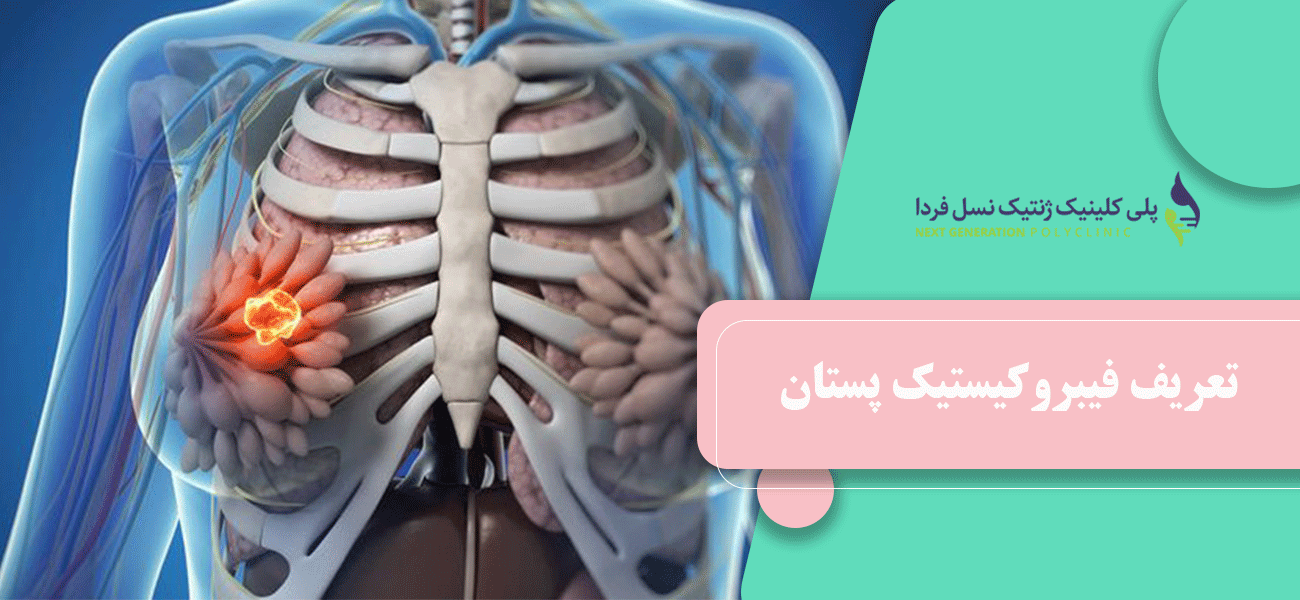 تعریف فیبروکیستیک پستان