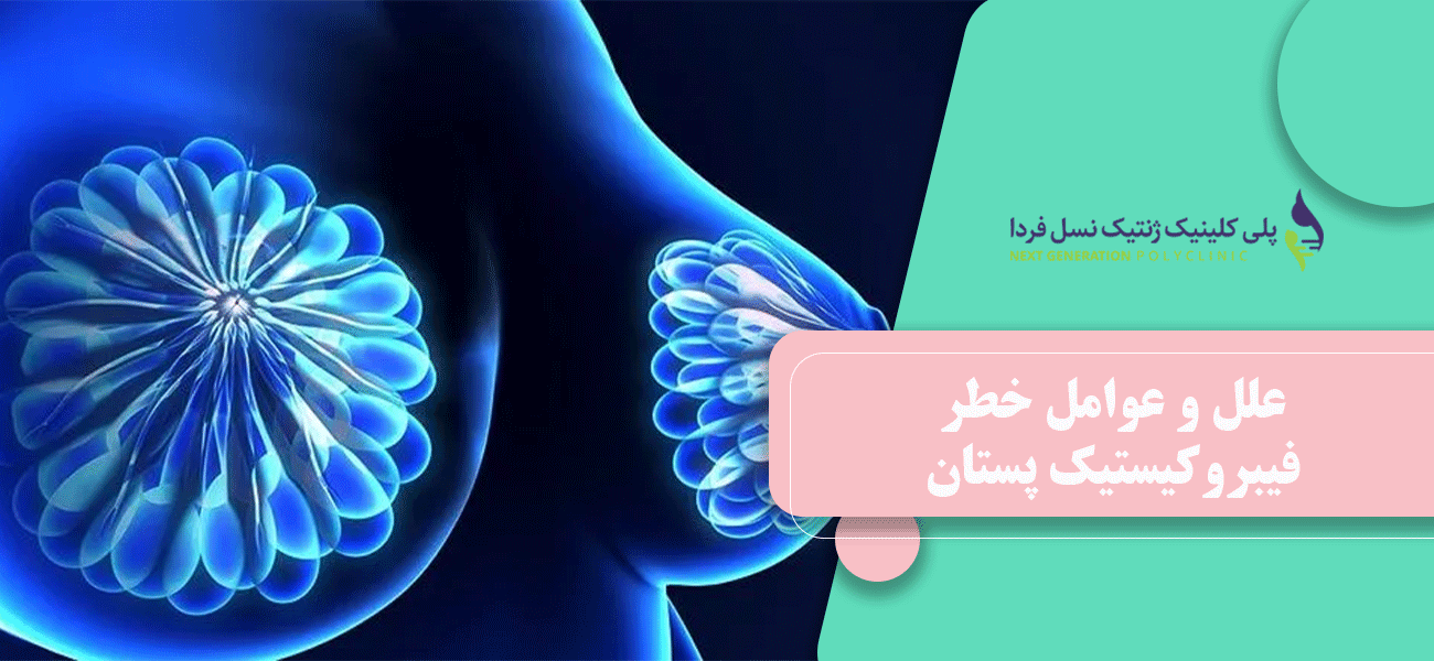 علل و عوامل خطر فیبروکیستیک پستان