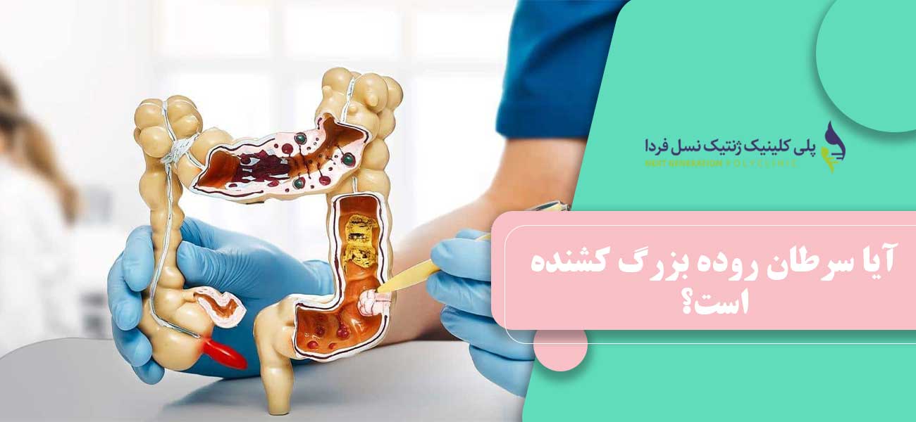 آیا سرطان روده بزرگ کشنده است؟