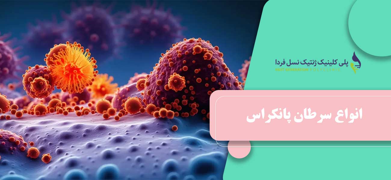 انواع سرطان پانکراس