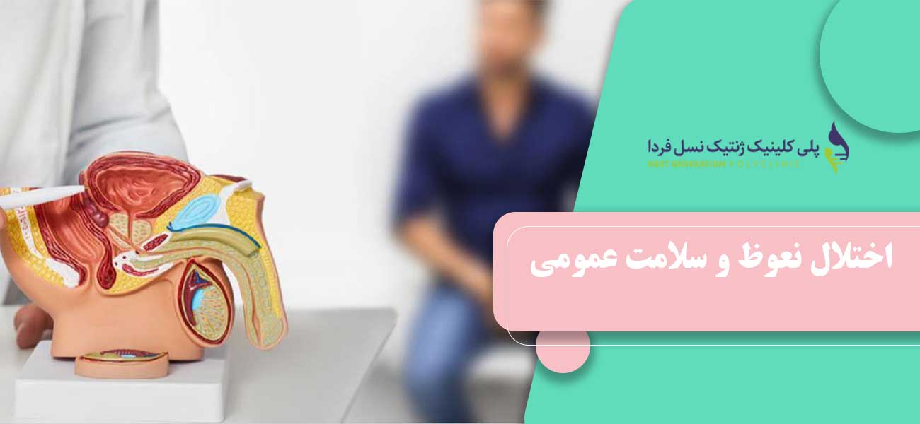 اختلال نعوظ و سلامت عمومی