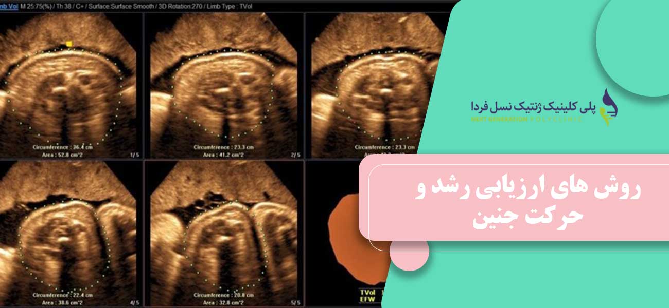 روش های ارزیابی رشد و حرکت جنین