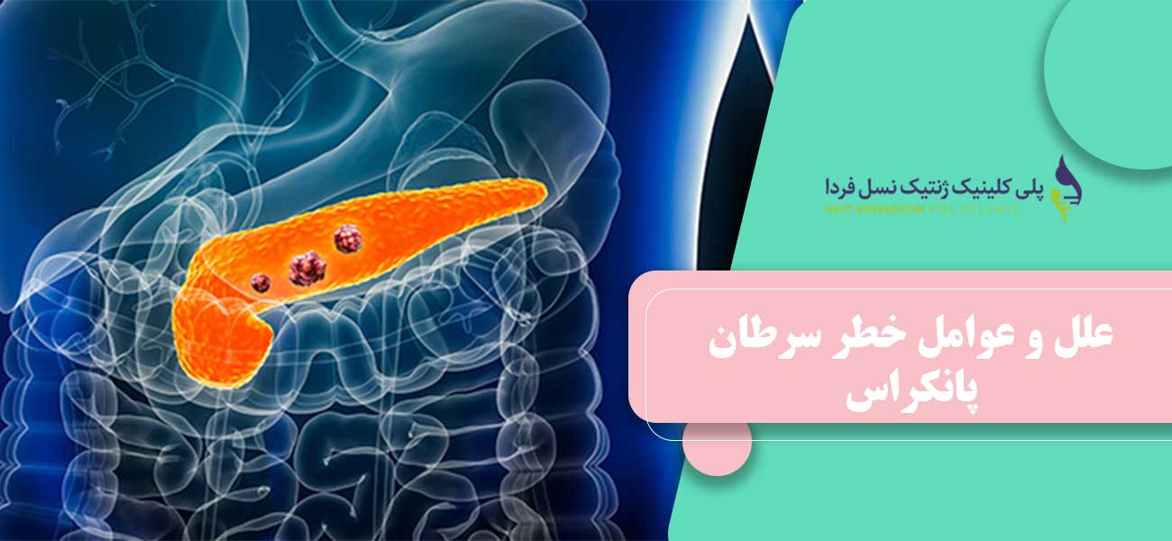 علل و عوامل خطر سرطان پانکراس