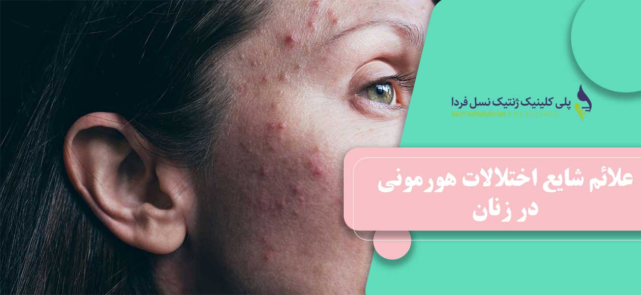 علائم شایع اختلالات هورمونی در زنان
