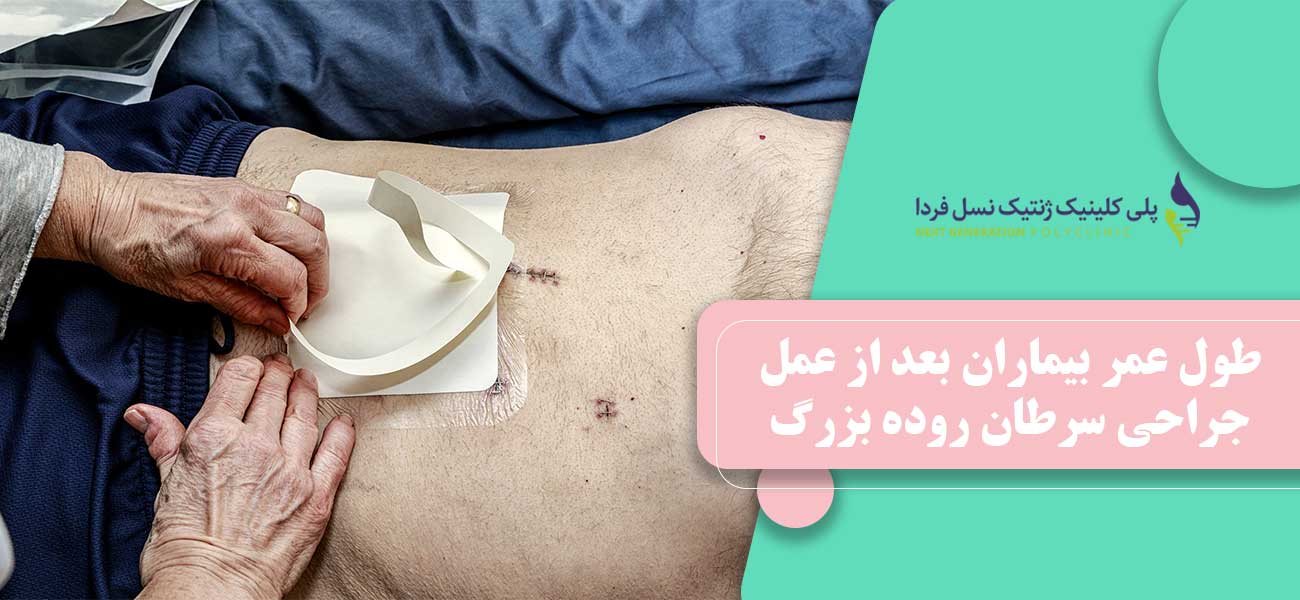 طول عمر بیماران بعد از عمل جراحی سرطان روده بزرگ