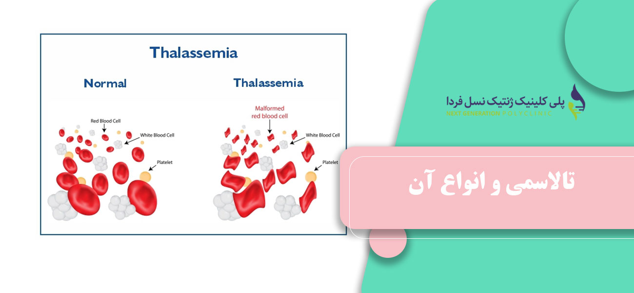 تالاسمی و انواع آن