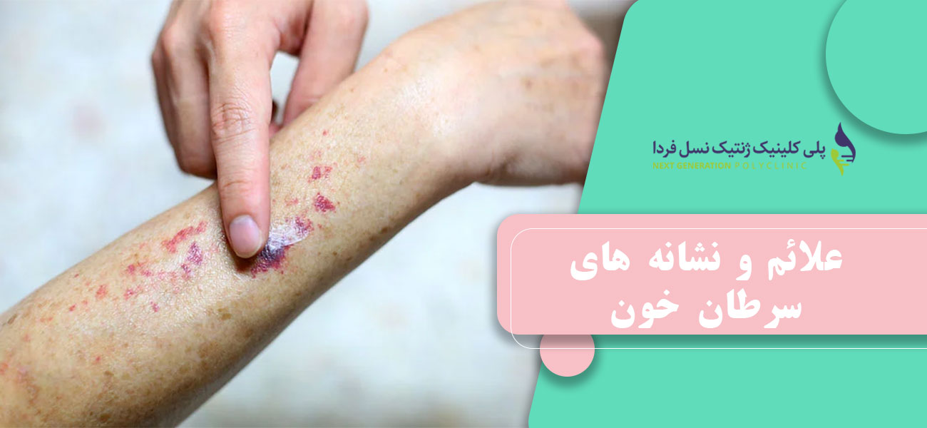 علائم و نشانه های سرطان خون
