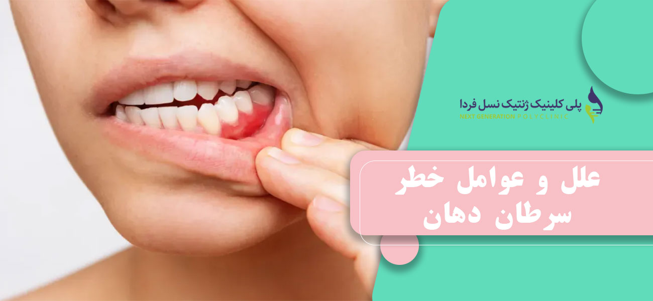 علل و عوامل خطر سرطان دهان