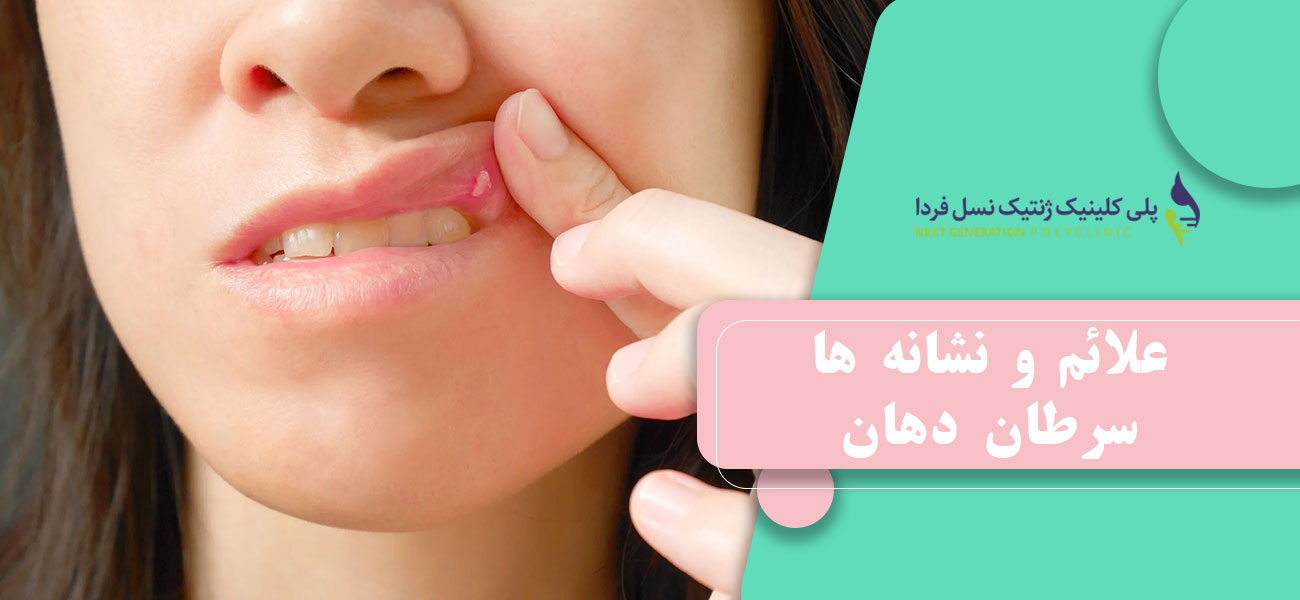 علائم و نشانه ها سرطان دهان