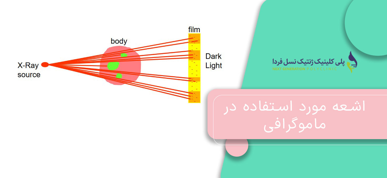 اشعه مورد استفاده در ماموگرافی