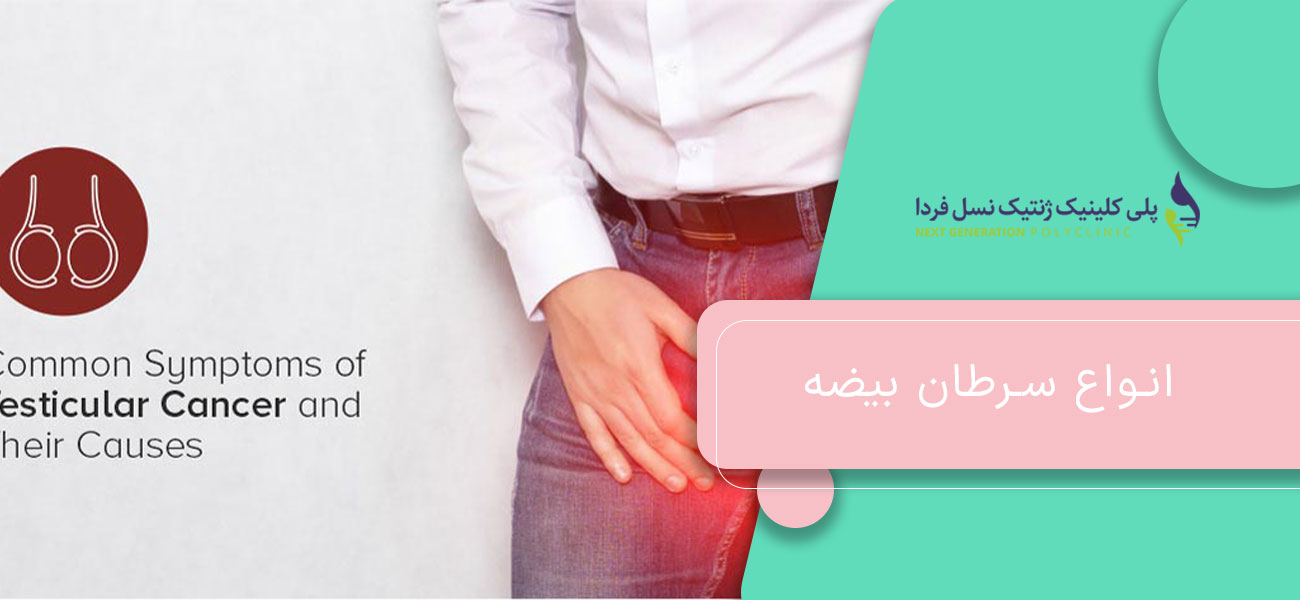 انواع سرطان بیضه