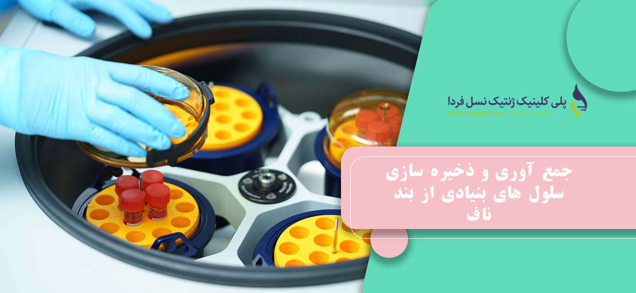 جمع آوری و ذخیره سازی سلول های بنیادی از بند ناف