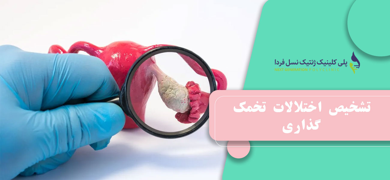 تشخیص اختلالات تخمک گذاری