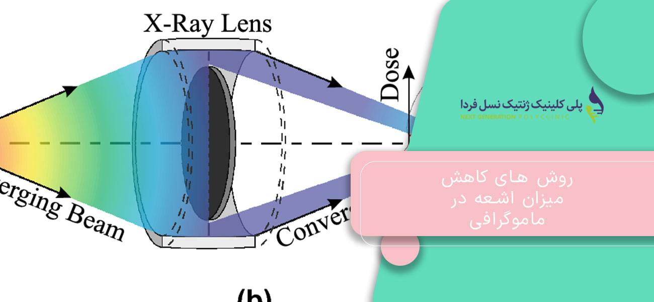 روش های کاهش میزان اشعه در ماموگرافی
