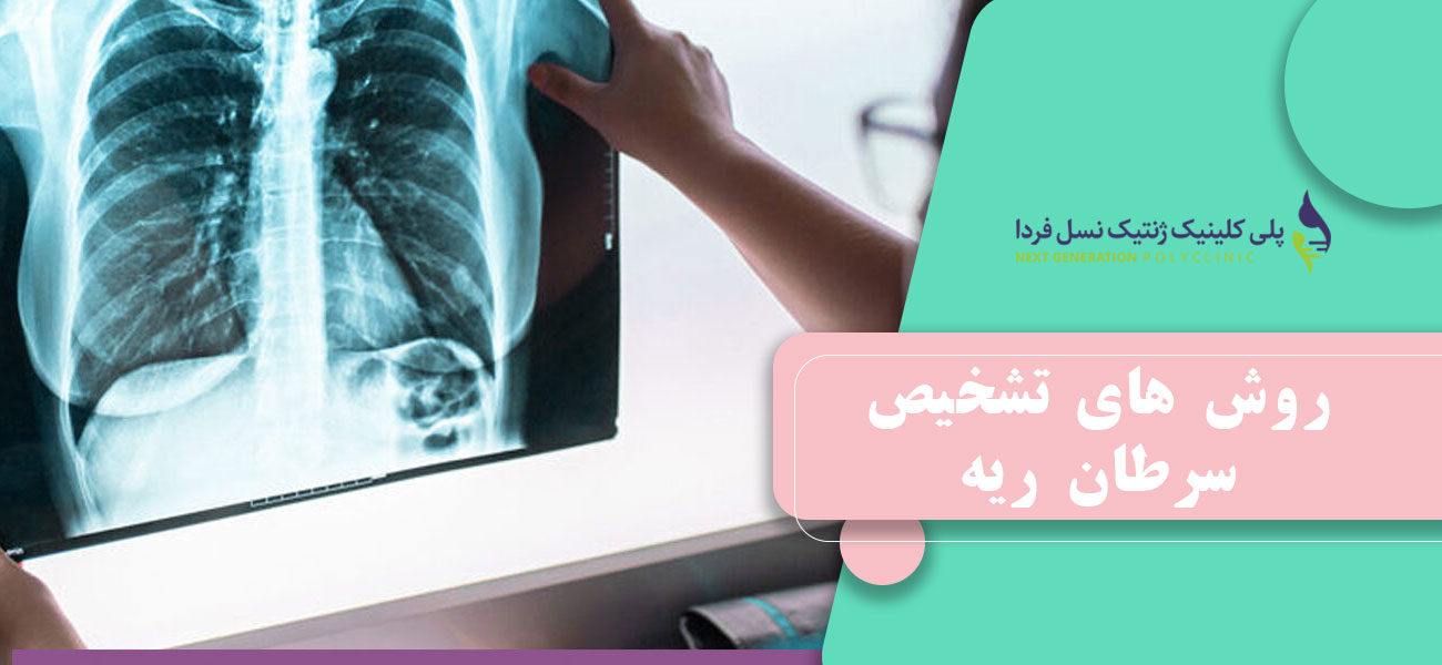 روش های تشخیص سرطان ریه