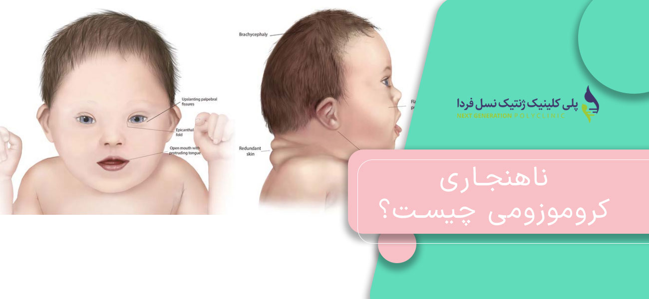 ناهنجاری کروموزومی چیست؟